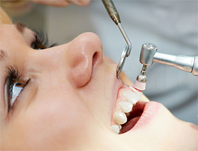 Преимущества профессиональной стоматологии